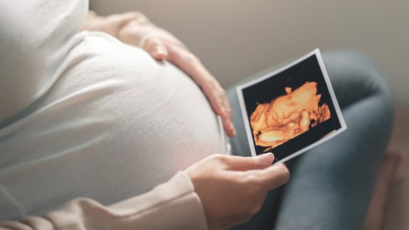 Pregnant woman with her hand on her abdomen looking at a color image of an ultrasound of the baby.
